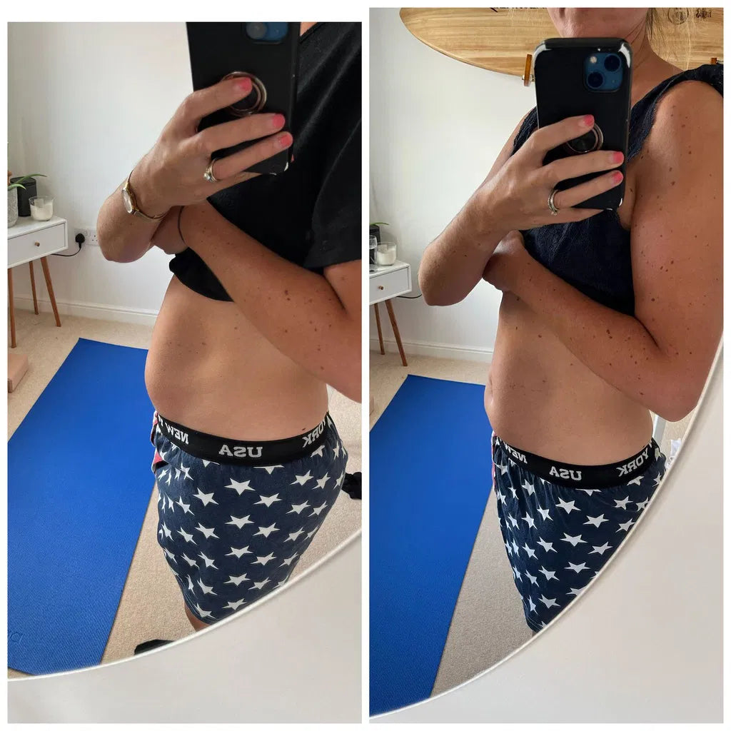 CHAU HINCHAZON ® | Cápsulas para la hinchazón abdominal